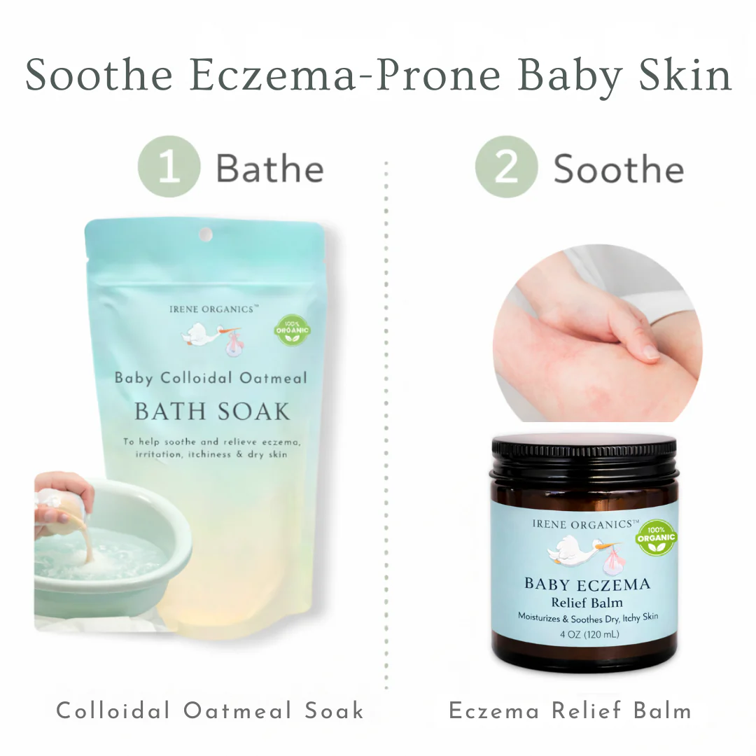 Irene Organics Baby Eczema Relief Bundle - Image 3