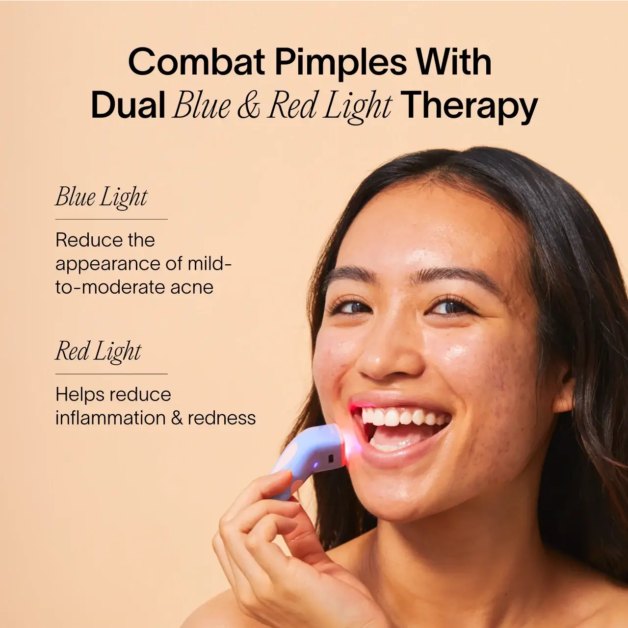 Solawave Bye Acne: 3-Minute Pimple Spot Treatment - Image 10