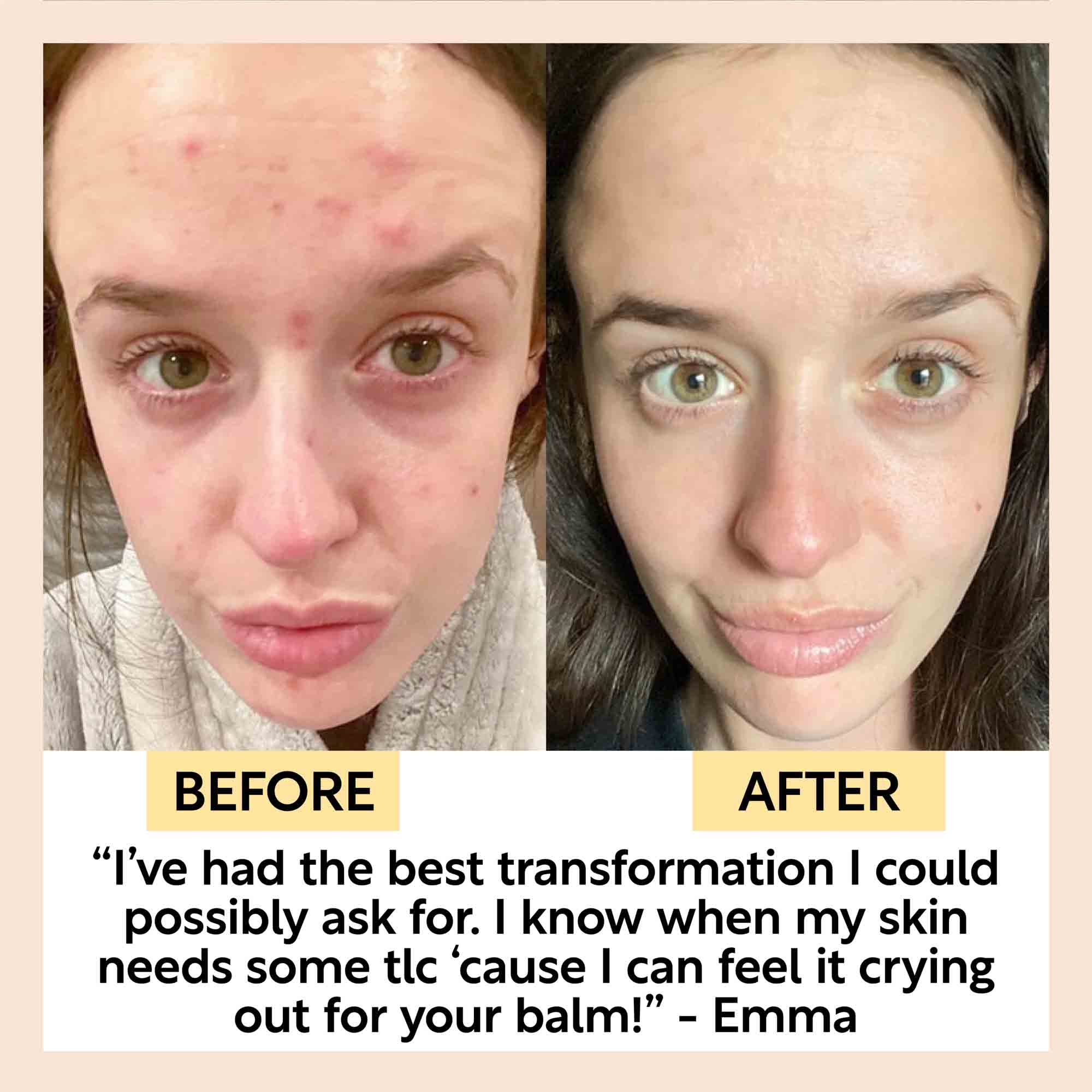 UpCircle Cleansing Face Balm with Oat Oil + Vitamin E - Image 10