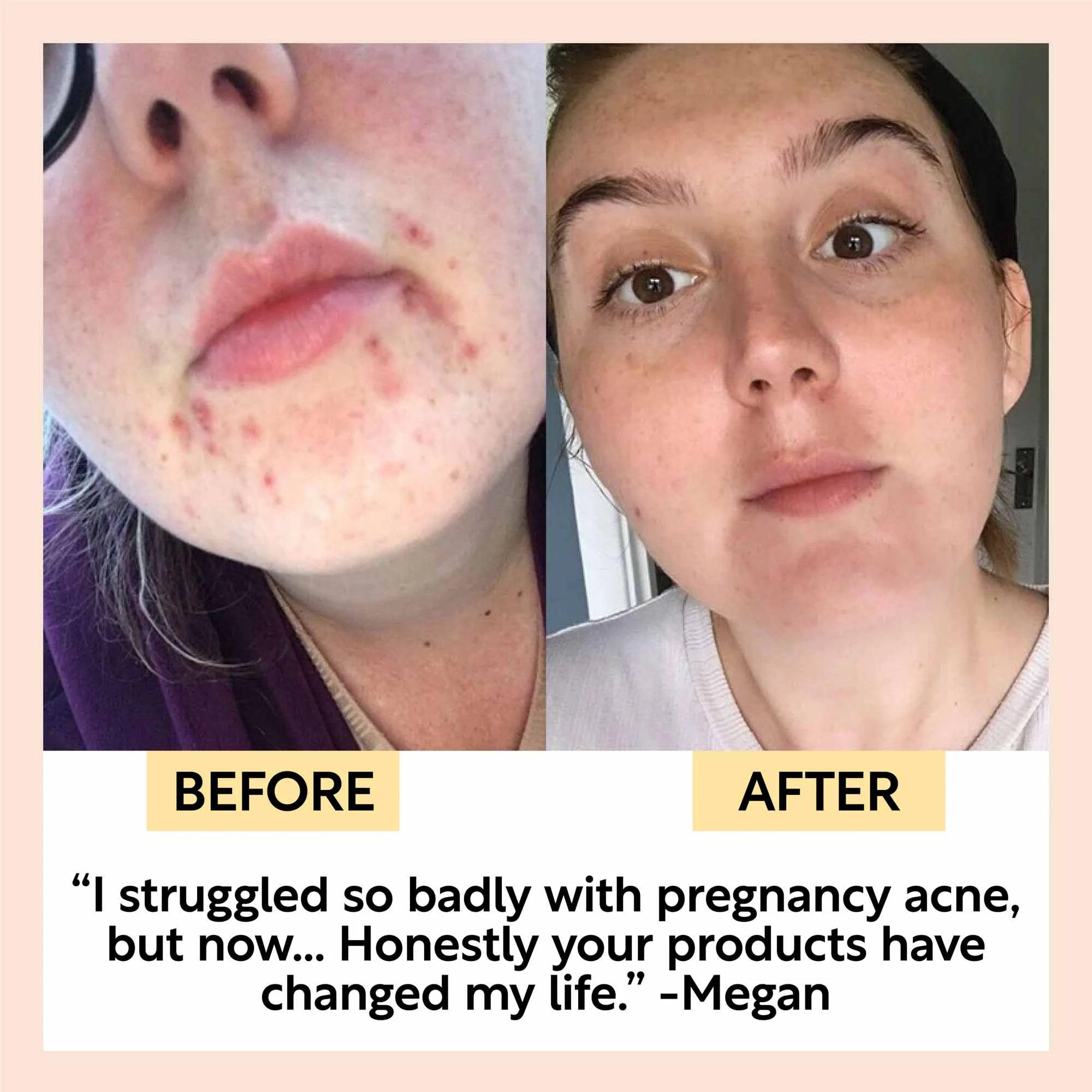 UpCircle Day + Night Hydration Set - Image 8