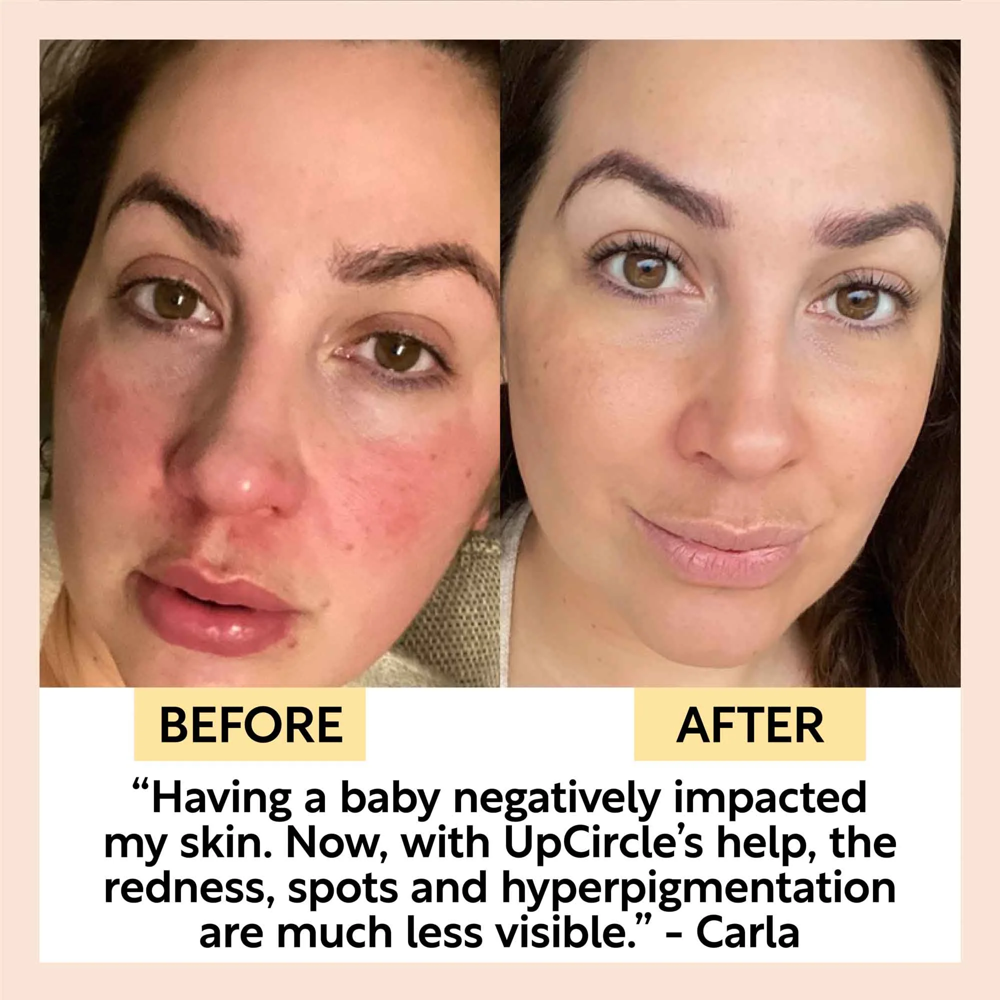 UpCircle Day + Night Hydration Set - Image 9