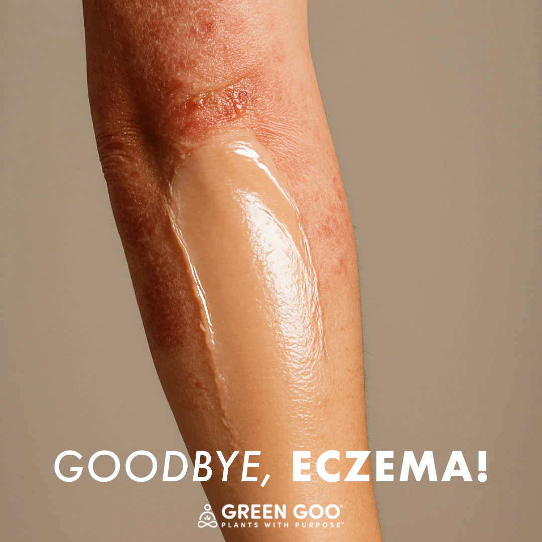 Green Goo Dry Skin - Image 17