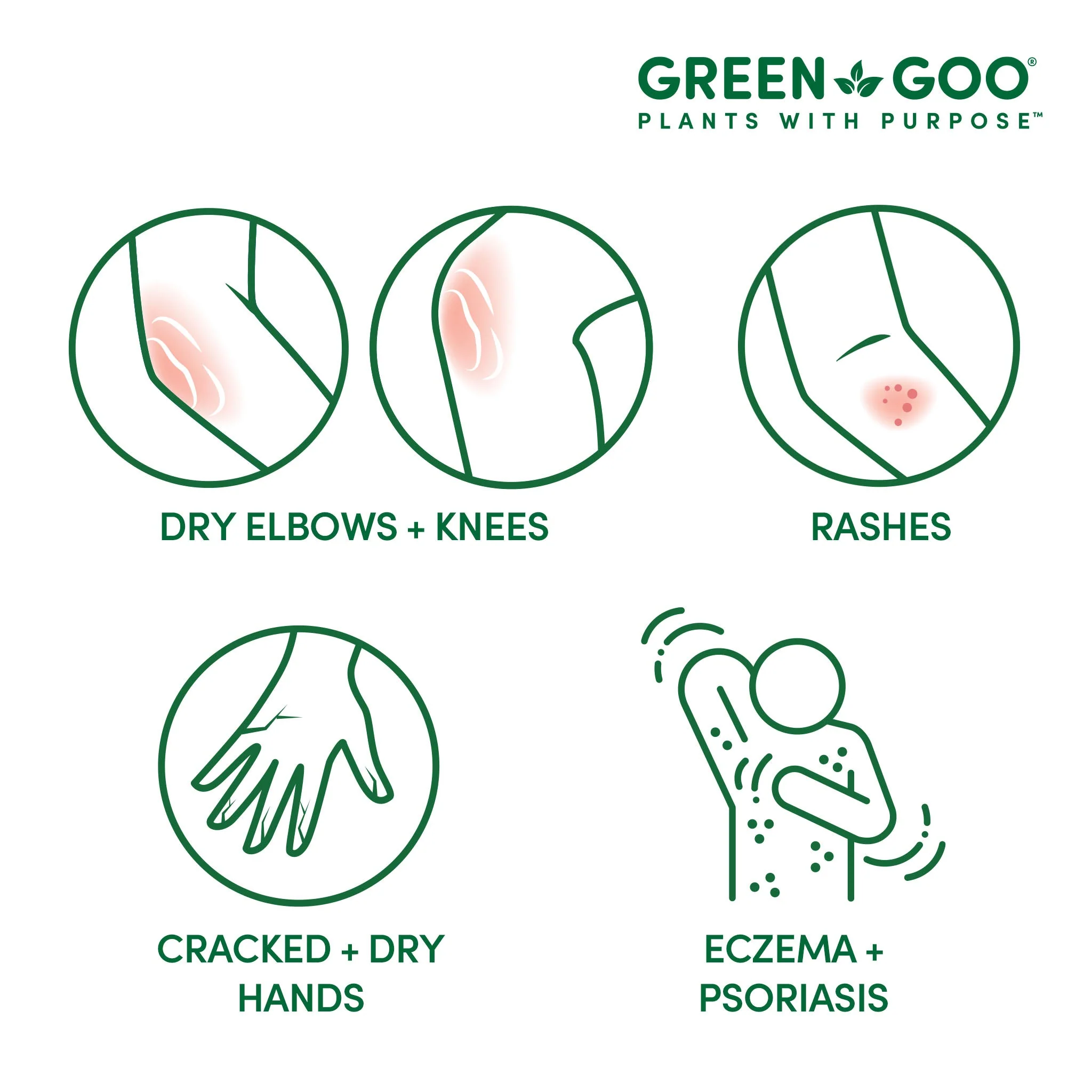 Green Goo Dry Skin - Image 8