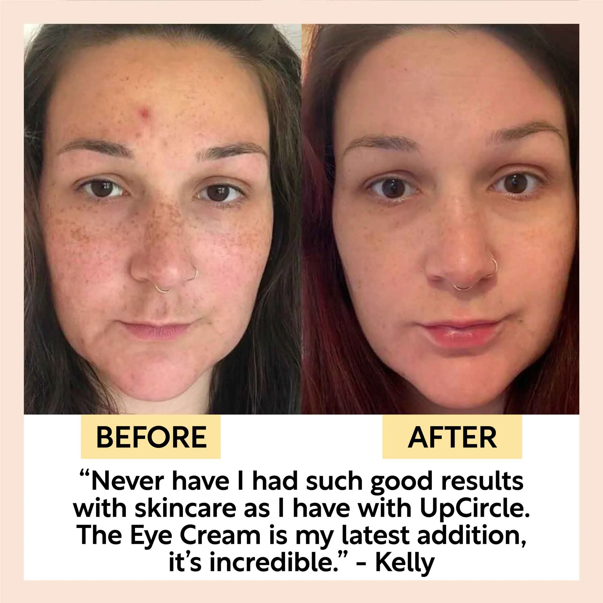 UpCircle Eye Cream with Hyaluronic Acid & Coffee - Image 9