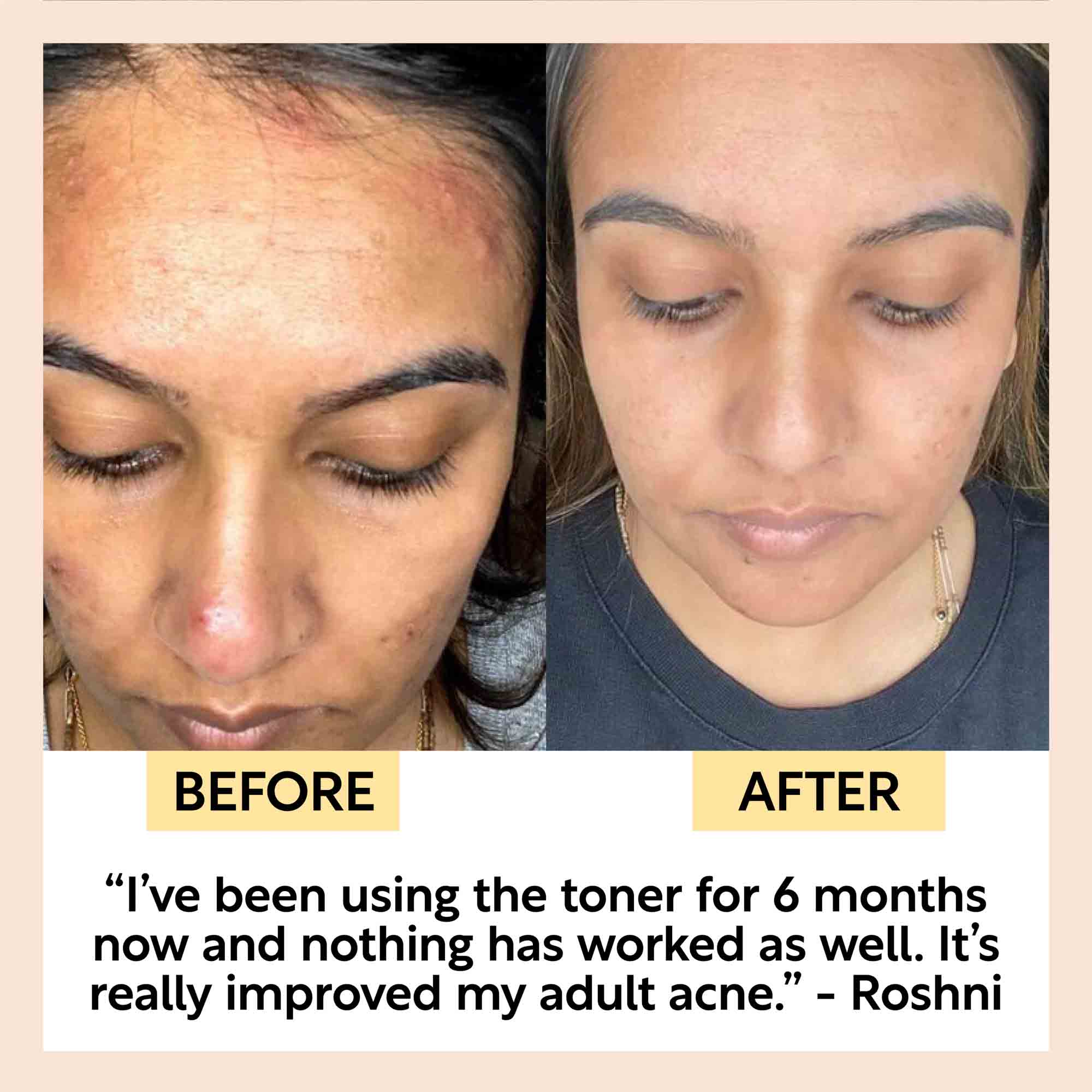UpCircle Face Toner with Hyaluronic Acid - Image 11