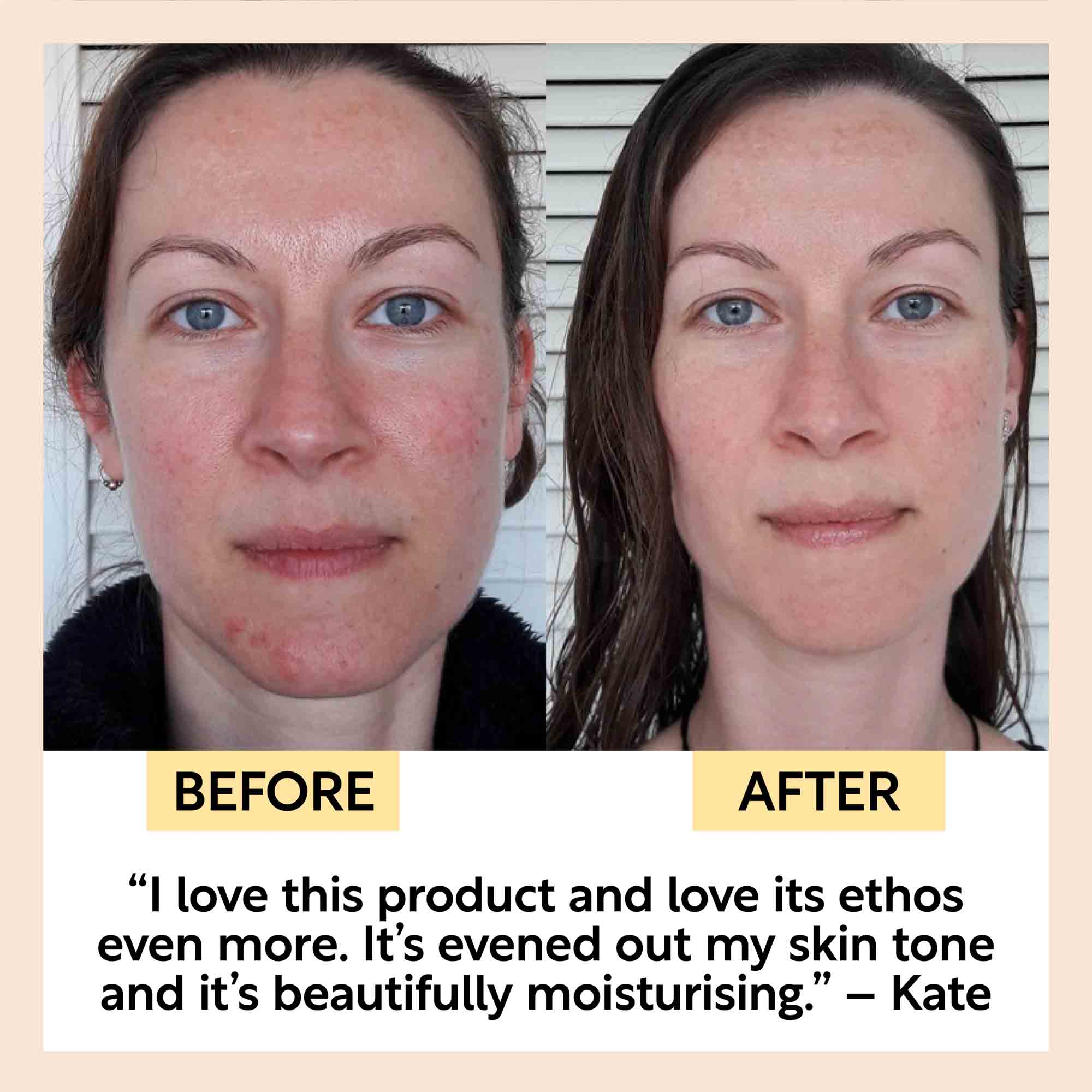 UpCircle Hydrating Face Oil with Coffee Oil - Jumbo - Image 10