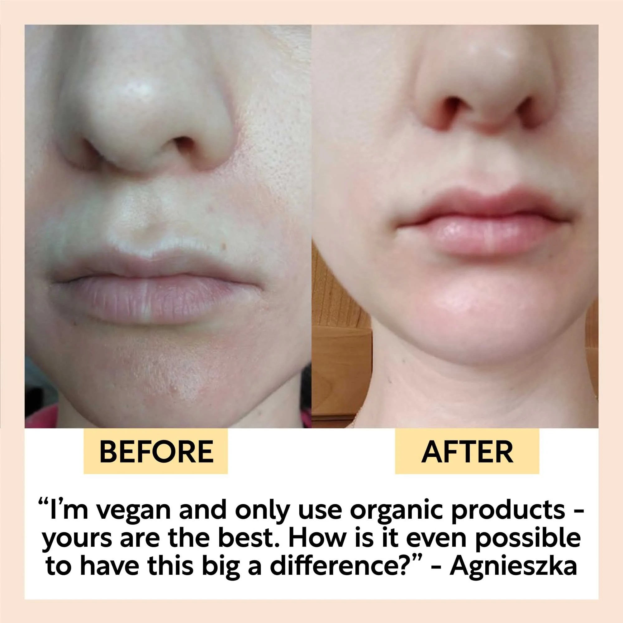 UpCircle Hydration Skincare Set - Image 7