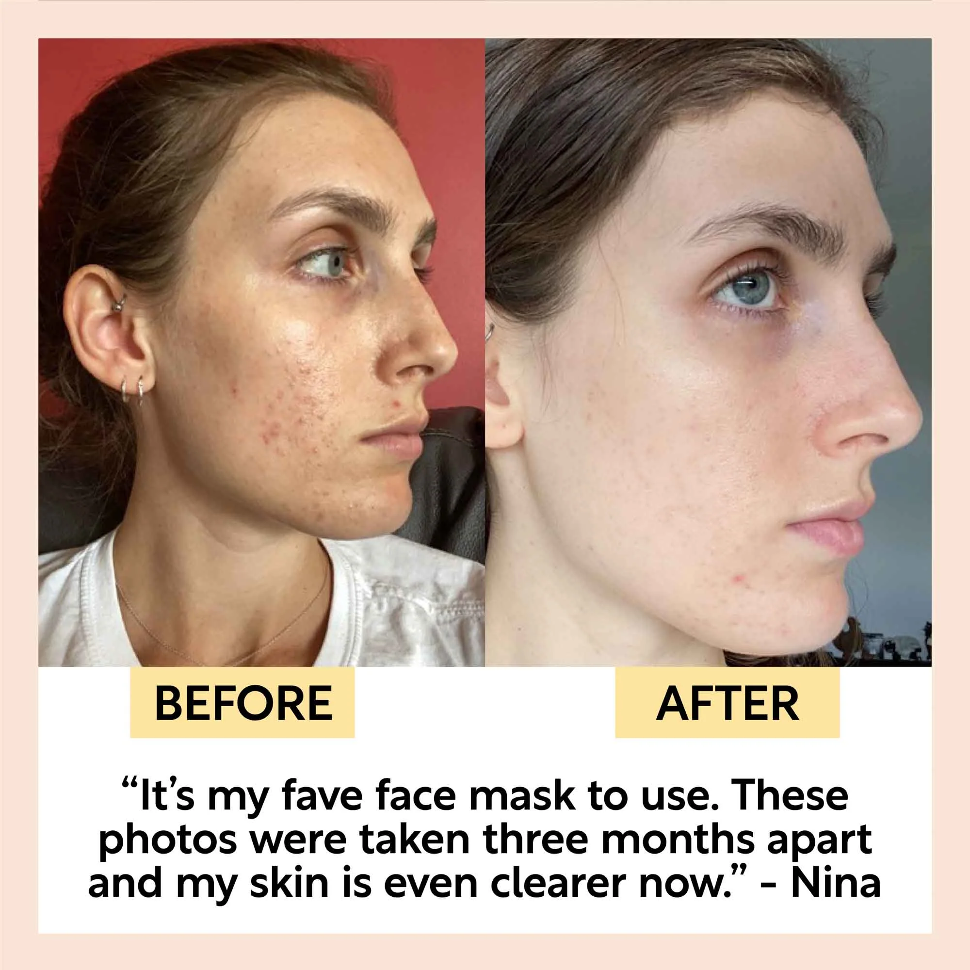 UpCircle Kaolin Clay Face Mask - Image 8