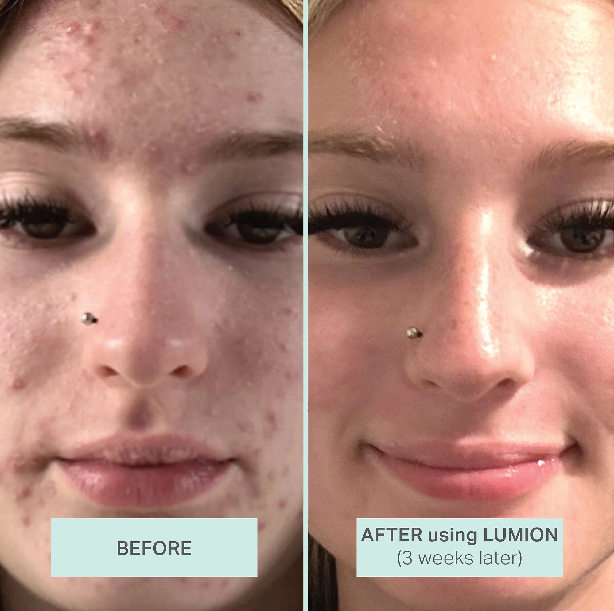 Lumion Miracle Mask - Image 4