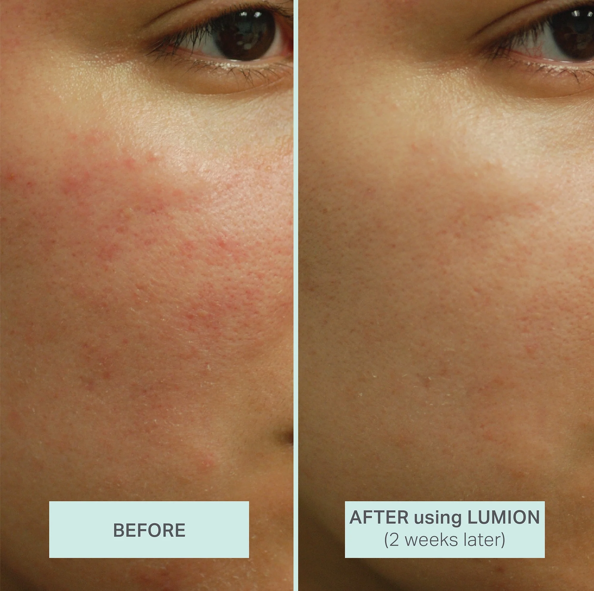 Lumion Miracle Mist - Image 3