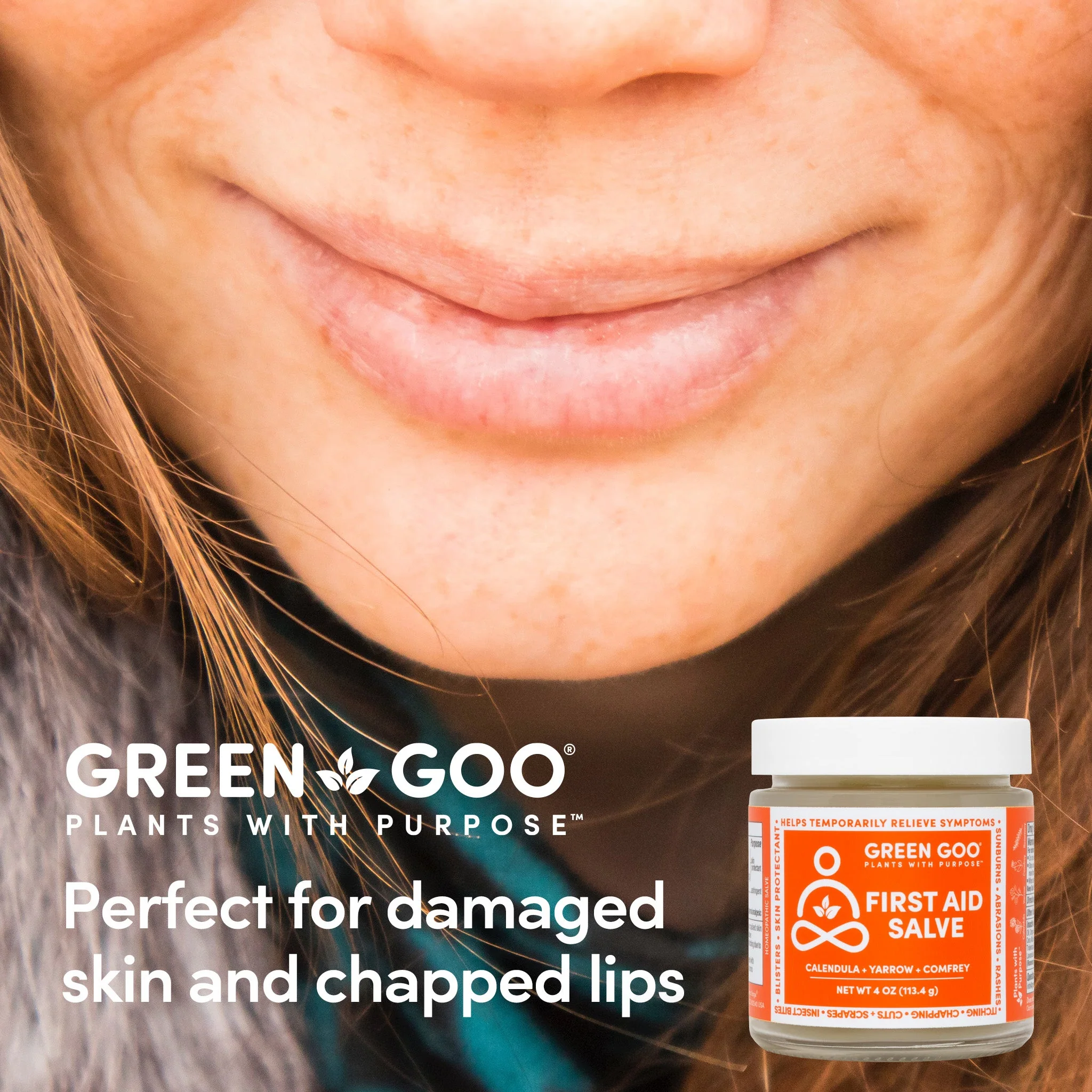 Green Goo Natural First Aid - Image 14