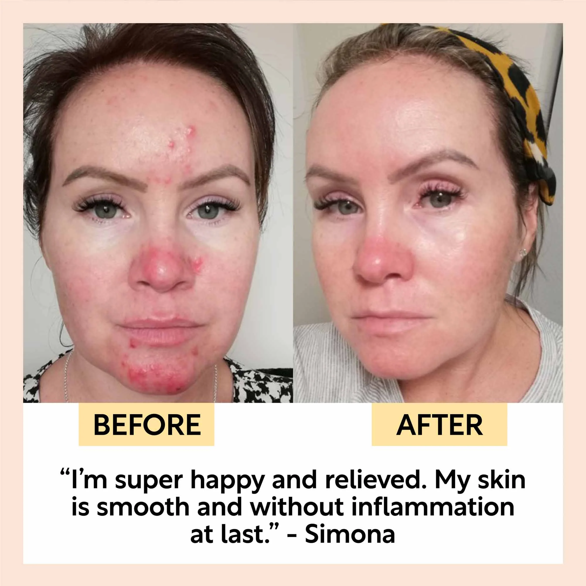 UpCircle Night Cream with Hyaluronic Acid + Niacinamide - Image 9