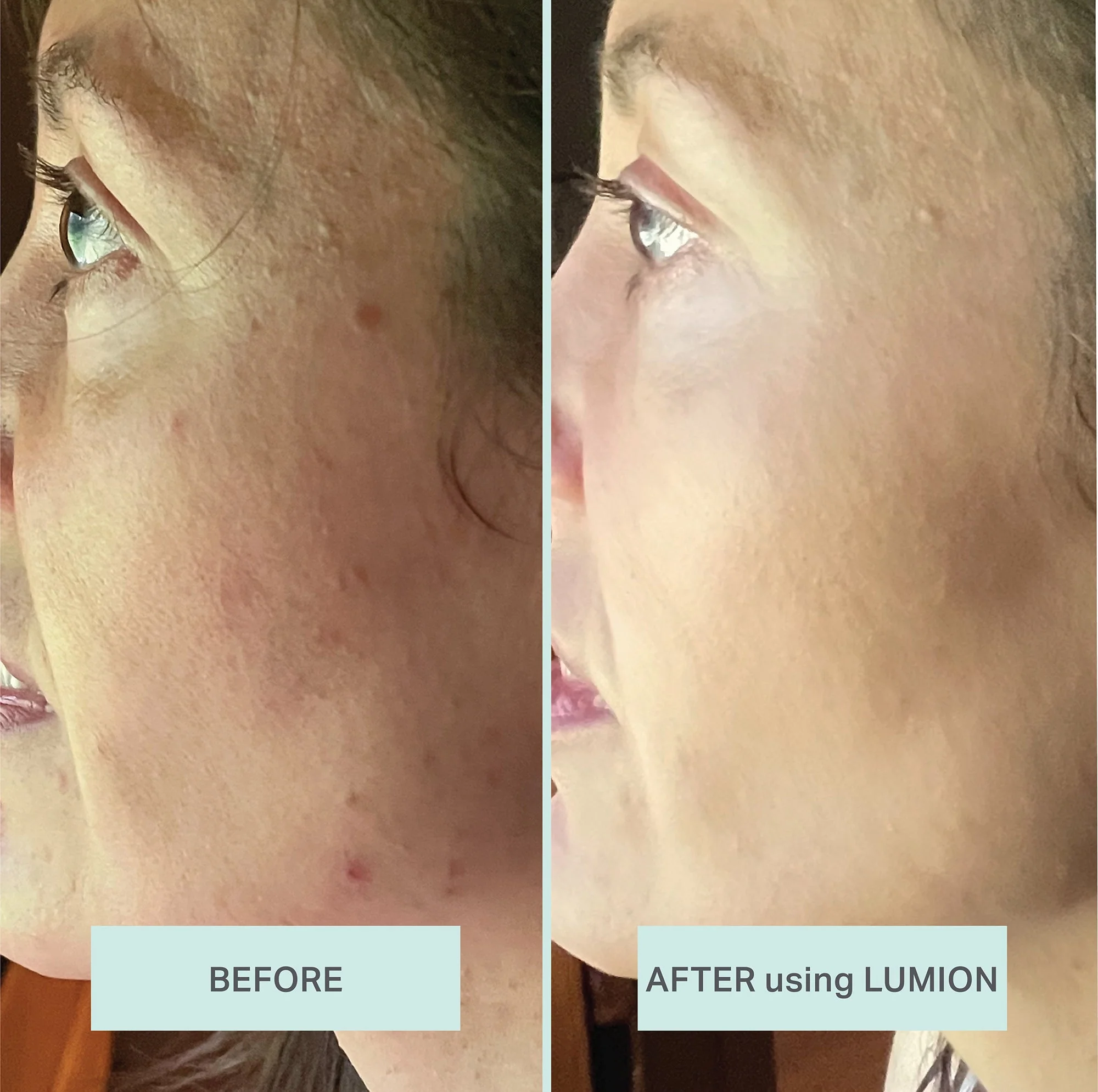 Lumion Save My Skin Serum - Image 4