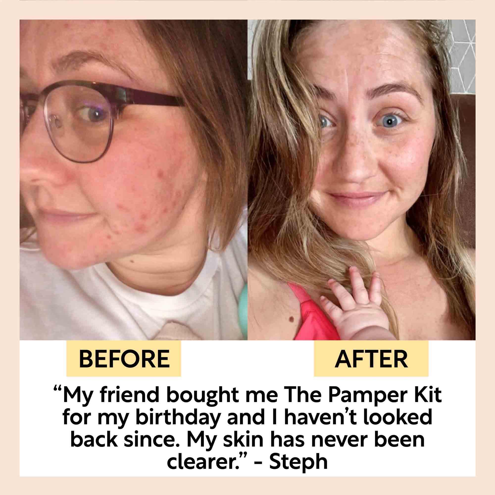 UpCircle The Pamper Kit - 17 Pieces - Image 8