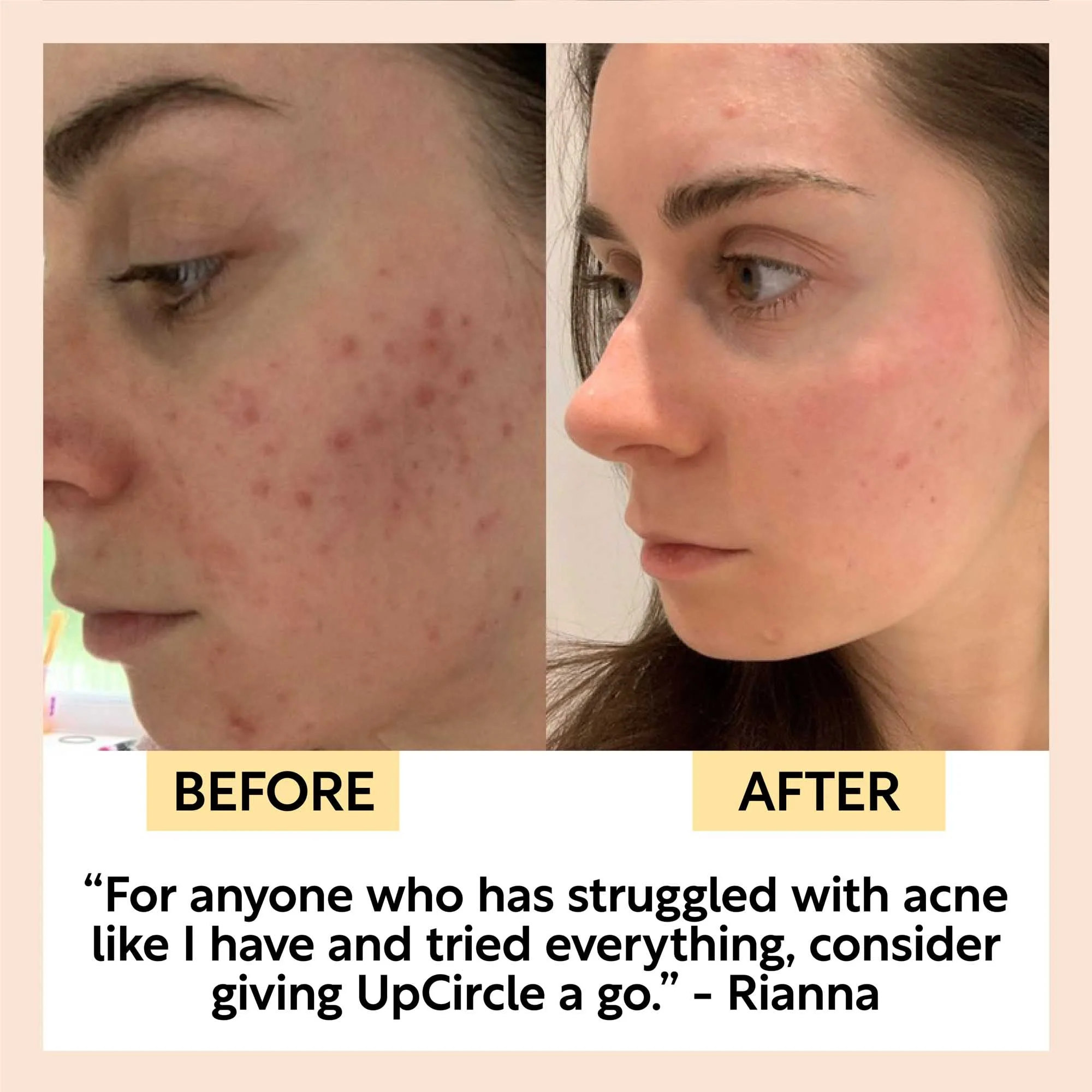 UpCircle Travel-Size Skincare Bundle - Image 6